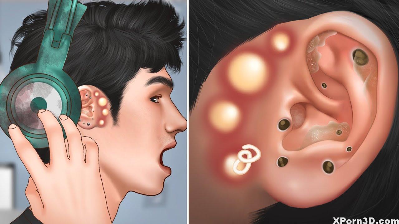 ASMR Pimple blackhead and sebaceous cyst elimination for gamer | Therapeutic massage ear – Tingle animation